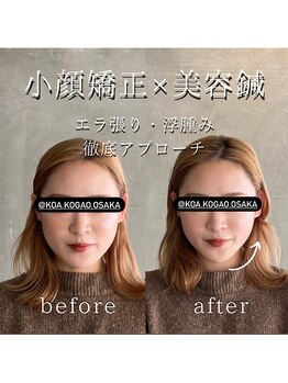 コア 中目黒店(Koa)/お客様ビフォーアフター!!