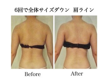 ナチュラーレ 天王寺店(Naturale)/痩身リンパマッサージ二の腕美脚