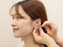 丸太町骨盤整骨院 鍼灸院/眼精疲労・スマホ疲れ耳ツボ