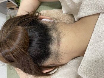 ナノハナ/鹿沼市全身脱毛美容室ナノハナ