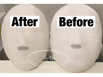 美極 銀座店/銀座/小顔コルギ/小顔矯正