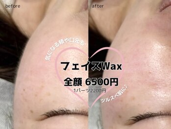 フルール 錦糸町店(Fleur)/フェイスWAX