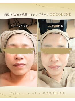 心音/若々しいツヤハリ肌へ。