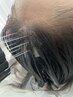 頭皮のお悩み解決ヘッドスパ