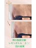 【噂の】脂肪分解レモンボトルで気になるところの脂肪撃退