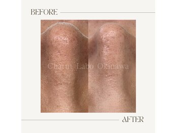チャームラボ オキナワ(Charm Labo Okinawa)