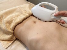 ダーマ(Derma)/ムレやニオイ予防!メンズVIO脱毛