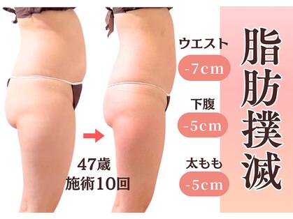 エルナ(Eluna)の写真