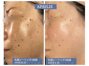 アプリリス(APRILIS)/お肌に透明感が欲しい方必見！