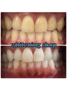 ホワイトニングショップ 南堀江店/セルフホワイトニング［四ツ橋］
