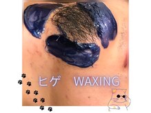 グルーミー(gloomy)/髭脱毛★men's脱毛★