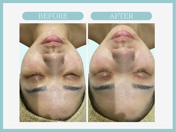 アコガレコガオ 秋田店/