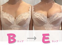 ヴィーナス(Venus)の雰囲気（【平均2～4カップUP】鏡を見るたび自信をくれる自分の美Body!）