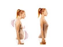 ハビジム(HabiGym)/整体ビフォーアフター 