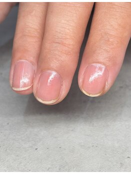 ハルズネイルラボ(HAL's Nail Lab)/究極甘皮ケア