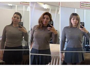 ベル(Belle)/【お腹スッキリ】脂肪冷却