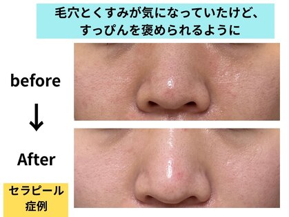 ノエル(Noel)の写真