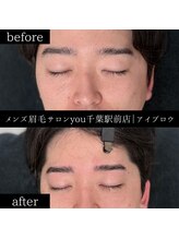 ユー 千葉駅前店(you)/ビフォ－アフター写真