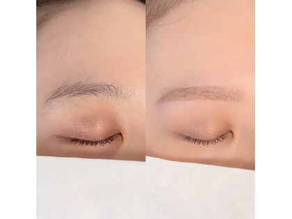 リィプラス(Re+)の写真