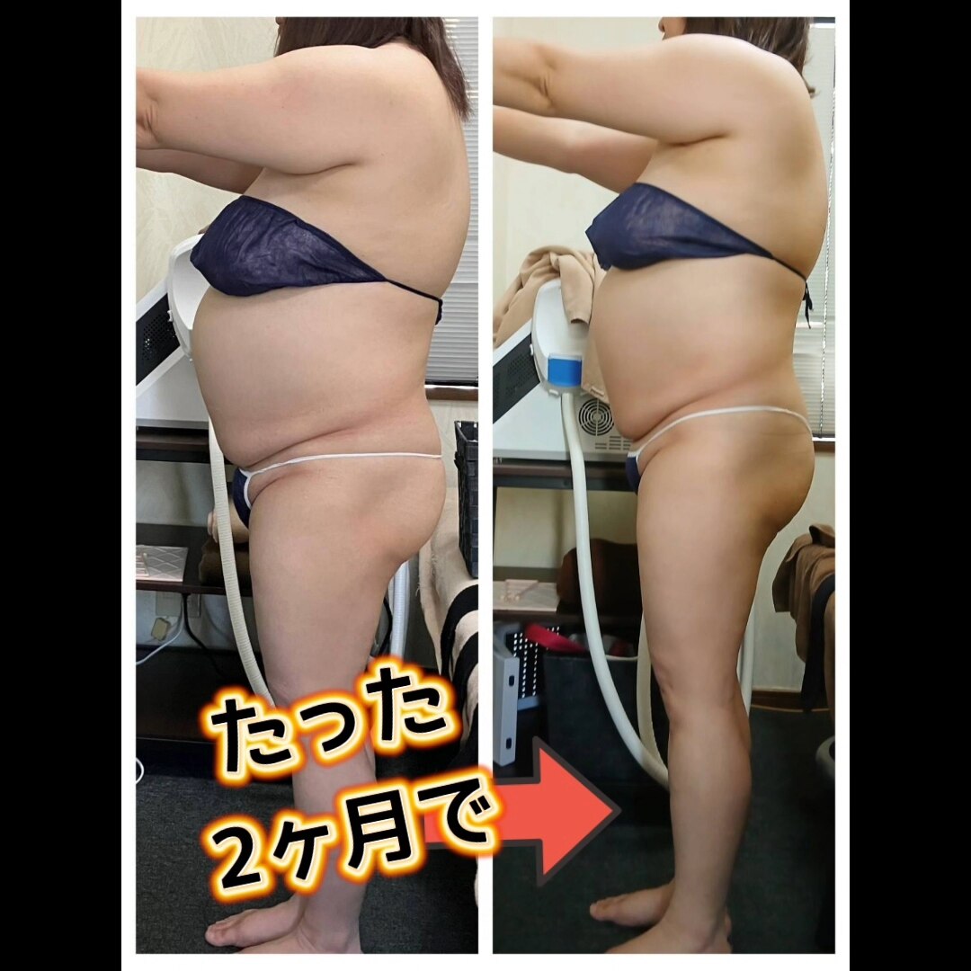 大阪市旭区でキャビテーションが人気のエステサロン｜ホットペッパー