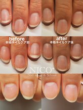 ニコプラス(NICO+)/ジェルネイルができない方向け