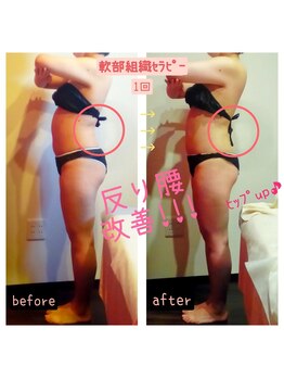 ビューティサロン キヨの部屋(beauty salon)/【軟部組織セラピー】 １回 &nbsp;