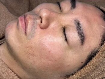 ホワイトアクア 岐阜店(WHITE AQUA)の写真/憧れの美容男子★モテ肌/美白/毛穴ケア★10回のエステより1回のハーブピーリング/ニキビケアにも！