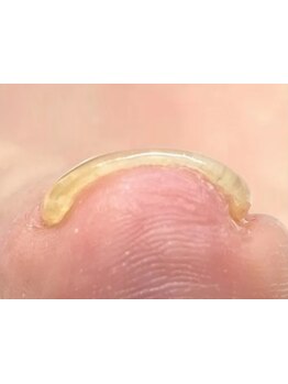 フットネイルがおすすめのサロン