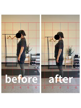 熊本カワル整体 JR上熊本駅院/猫背矯正