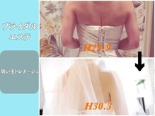 エステティックサロンティエリー/ブライダルエステ４