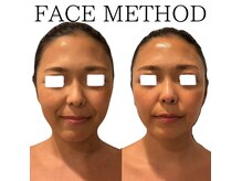 エミナル(EMINALu)の雰囲気（ビフォア1回/リフトアップ/二重顎/食いしばり/たるみケア/小顔）