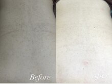 レシェルサロン(Lechelle Salon)/背中のハーブピーリング