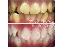 ホワイトニングルーム 横浜店(Whitening Room)/ホワイトニング/横浜