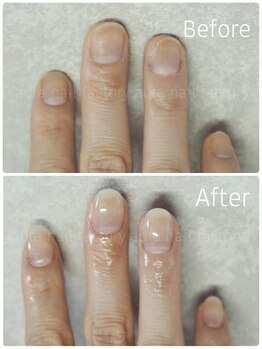 アウラ ネイル ファクトリー(aura nail factory)/深爪矯正スカルプ長さだし自爪風