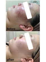 エステティック レイビス 秋田店(RAYVIS)/