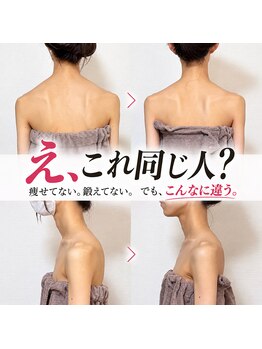 リュウ(le.lieu)の写真/体重は変わらないのに、見た目が全然違う!40代からも大丈夫☆挙式前のドレス映えケアにも☆