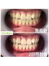 ルブラン 奈良店(Le Blanc)/ブライダルコースSTART！