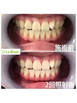 ルブラン 奈良店(Le Blanc)/ブライダルコースSTART！