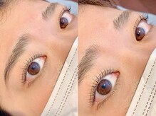 アミー 柏店(amii.)/ハリパリ同時施術