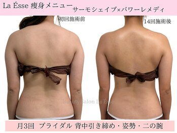 ラエッセ(La Esse)/背中のもたつき・厚みもすっきり