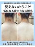 【レディース●】オフショル映え◎ うなじ・二の腕上・背中上部まとめて脱毛