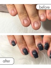 ピノ(pino)/◆深爪矯正＋長さだしアート◆