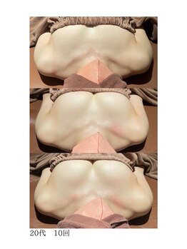 ロココ 豊田店(Rococo)/ビフォーアフター