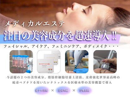 ルーナ(LUNA)の写真