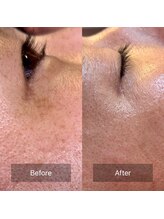 パンダ(Panda)/魔女美鍼