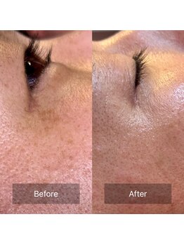 パンダ(Panda)/魔女美鍼