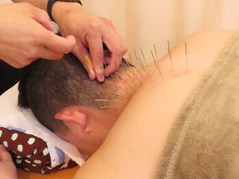 リサ鍼灸院(RISA鍼灸院)/ルート鍼