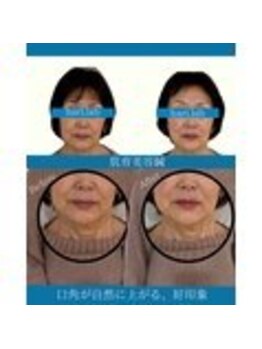 ハリラボ 仙台上杉店(hari Lab.)/【お客様の声】