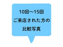 ホワイトニングショップ 甲賀店/