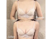 ジョリー(Jolie)/